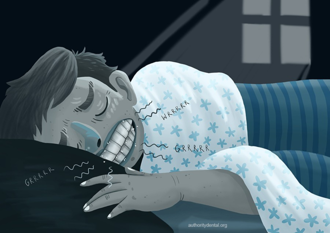 Cách giúp bạn ngừng nghiến răng khi ngủ