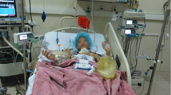 Thanh niên 17 tuổi bị ung thư phổi được ghép cùng lúc 2 lá phổi