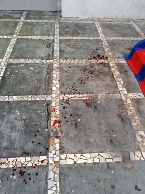 Bé trai 3 tuổi tử vong khi bị viên gạch rơi từ chung cư cao tầng trúng đầu