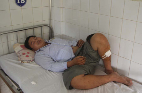 Chém 4 công an nhưng không bị xử lý hình sự vì tâm thần