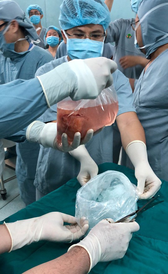 Mẹ quyết sinh con ra để lấy tạng cho người khác