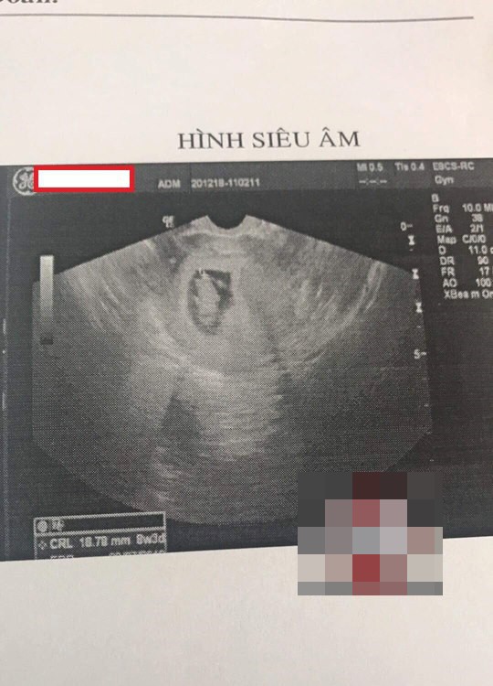 Làm bạn gái mang thai ngoài ý muốn, nam thanh niên ép phá bỏ còn nói: Con xuất hiện lúc này là sai thời điểm