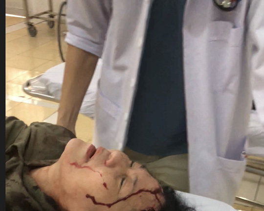 Bị hàng xóm tấn công kinh hoàng chỉ vì vũng nước đọng trước nhà!