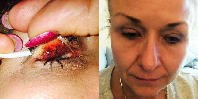 Kim siêu vòng 3 có 1 thói quen xấu mà nhiều phụ nữ cũng mắc phải và có người suýt bị mù