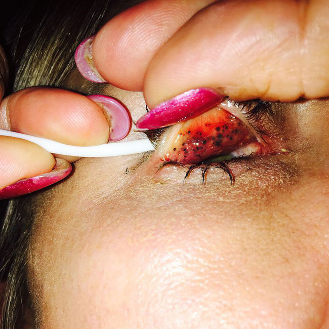 Kim siêu vòng 3 có 1 thói quen xấu mà nhiều phụ nữ cũng mắc phải và có người suýt bị mù