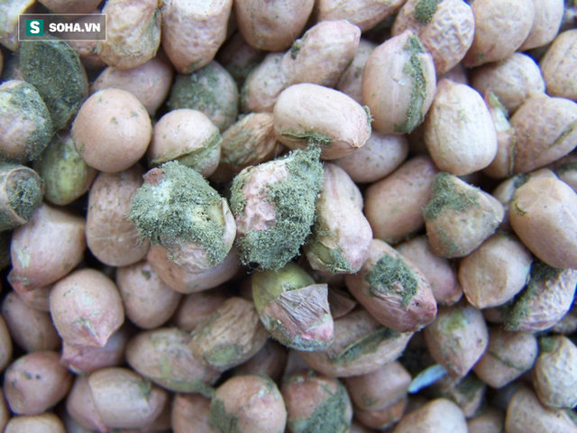 Báo động ung thư gan: Đứng đầu Việt Nam năm 2018, vượt qua ung thư phổi!