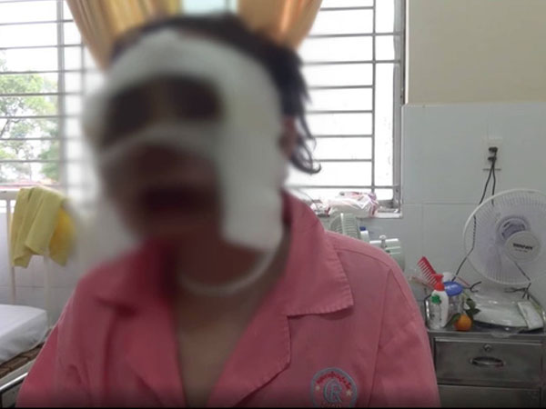 Công an huyện Củ Chi ráo riết truy bắt kẻ tạt axit cô gái sắp cưới