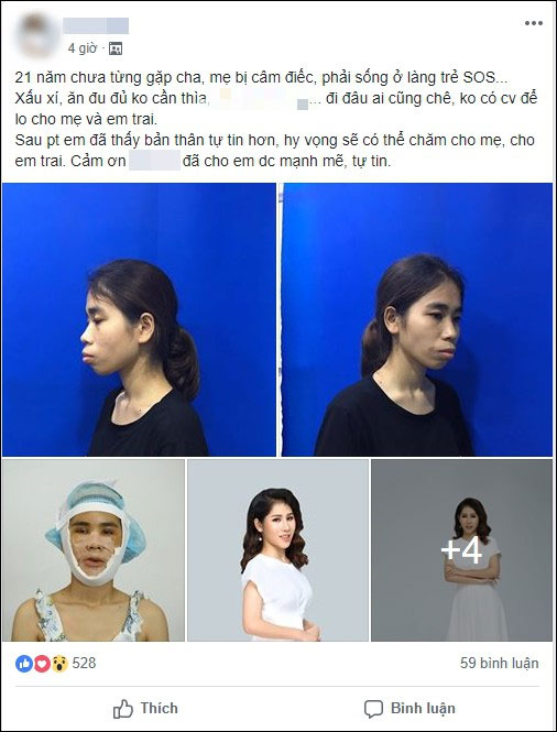 Bị chê ăn đu đủ không cần thìa, cô gái quyết tâm lột xác và thành quả bất ngờ khiến mẹ chỉ có thể nhận ra con gái qua vết sẹo