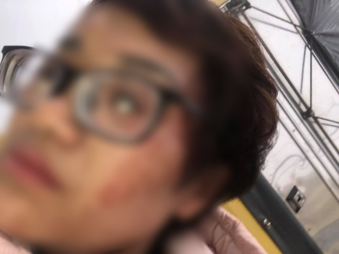 Thắc mắc tiền vé xe khách tăng thêm 100 nghìn, người phụ nữ bị túm tóc đập đầu đến chảy máu: Tài xế lên tiếng