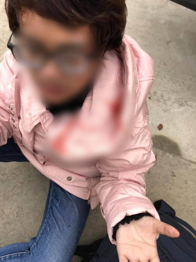 Thắc mắc tiền vé xe khách tăng thêm 100 nghìn, người phụ nữ bị túm tóc đập đầu đến chảy máu: Tài xế lên tiếng