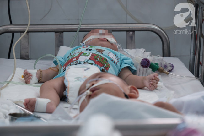 Thống kê sau khi 2 trẻ chết vì tiêm vắc-xin ComBE Five: 6/12 tỉnh ghi nhận có trẻ sốt cao kéo dài