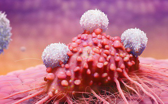 Bệnh ung thư người Việt mắc nhiều nhất năm 2018 là những loại nào?