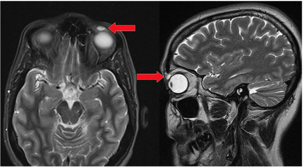 6 trường hợp y khoa kỳ lạ nhất 2018, hai người trong đó đã tử vong
