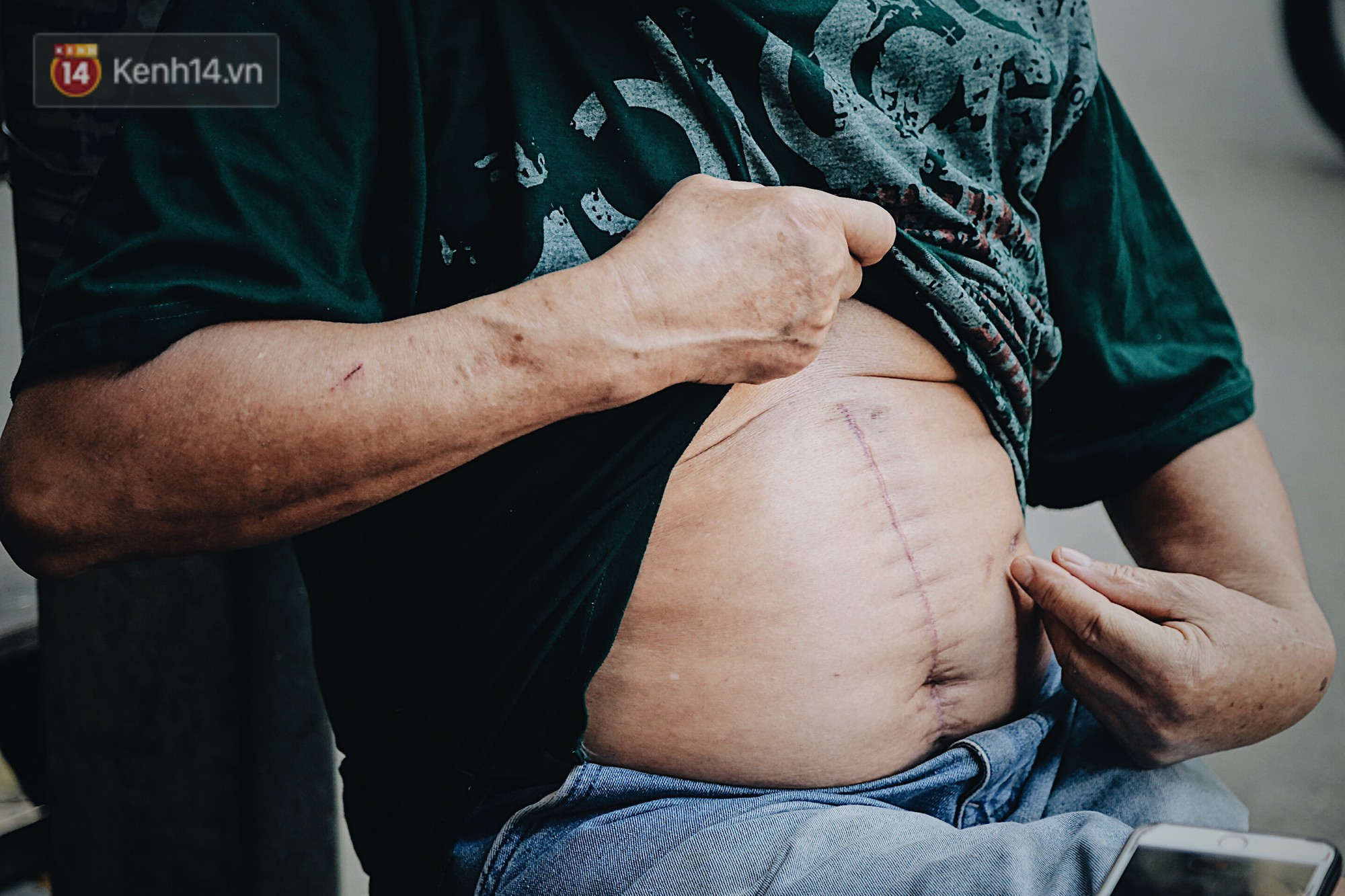 Câu chuyện về vết sẹo dài trên cơ thể người kéo chuông cuối cùng ở Nhà thờ lớn Hà Nội