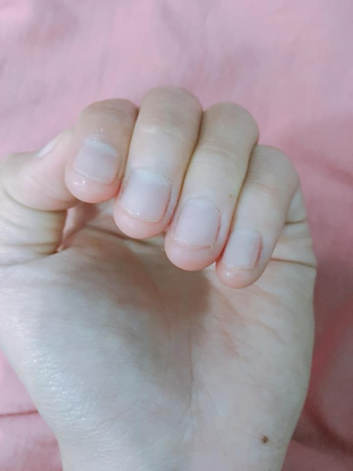 Có một kiểu người móng tay chẳng bao giờ nhú lên được vì cứ rảnh là ngồi cắn