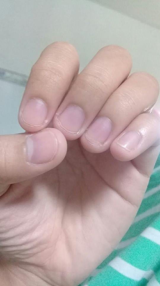 Có một kiểu người móng tay chẳng bao giờ nhú lên được vì cứ rảnh là ngồi cắn