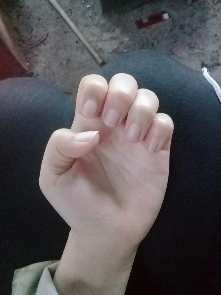 Có một kiểu người móng tay chẳng bao giờ nhú lên được vì cứ rảnh là ngồi cắn