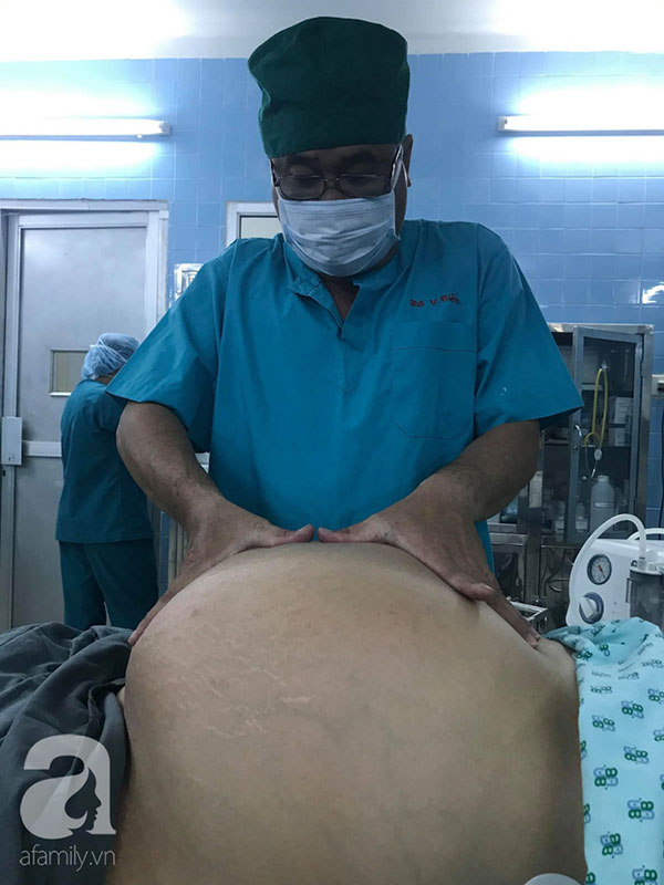 Từ 1 khối u nhỏ bị bỏ quên trong tử cung, 4 năm sau, người phụ nữ khổ sở vì khối u lớn khủng khiếp