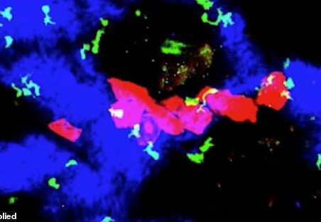 Phát hiện đột phá: Cơ chế giúp bệnh ung thư tự ngủ đông