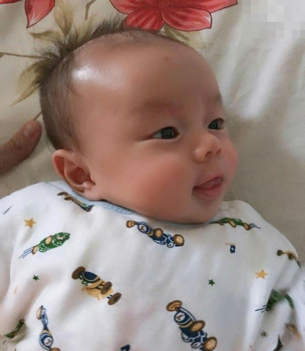 Tưởng chỉ bị tắc sữa, mẹ Bình Dương nuốt nước mắt đành cắt cụt tứ chi để được sống