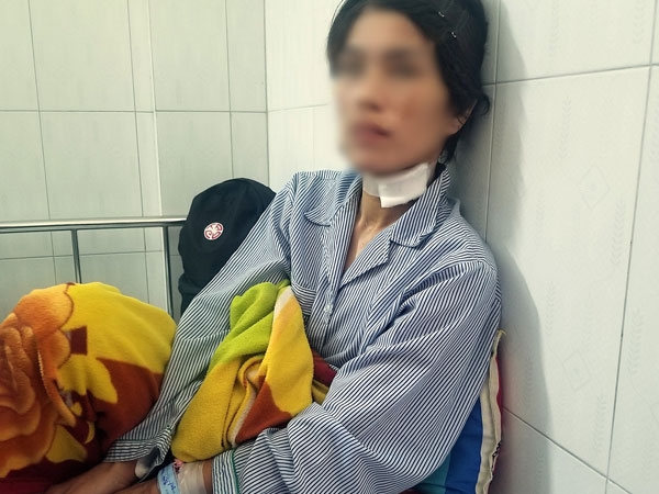 Người phụ nữ bị chồng cũ bạo hành, cắt lỗ tai dã man vì không cho mượn tiền