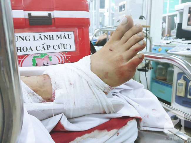 Thông tin mới nhất: 2 nạn nhân trong vụ container tông loạt xe máy ở Long An sắp được xuất viện