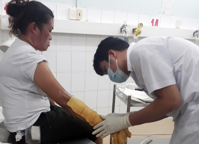 Nổ bình gas mini tại chợ đêm, 4 người bị bỏng