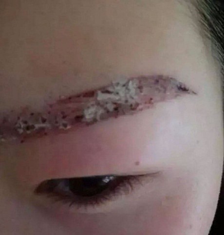 Làm đẹp để ăn Tết mà tiền mất tật mang, cư dân mạng thương tiếc nhưng chẳng nhịn nổi cười