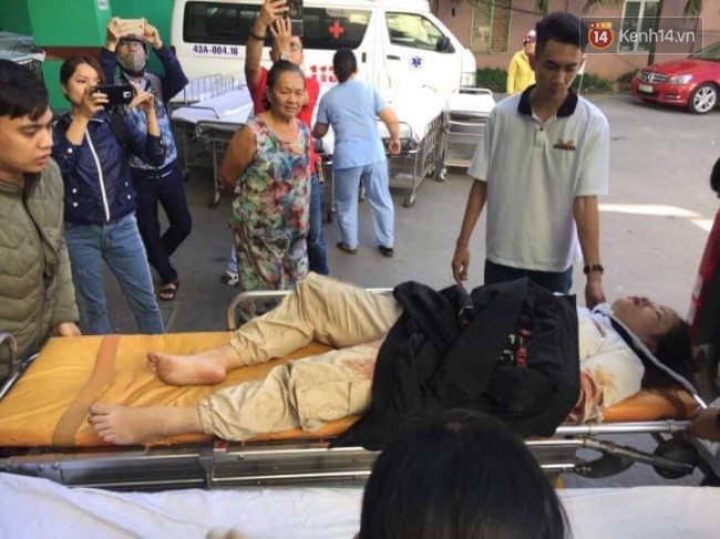 Cánh tay đứt lìa của nữ sinh trong vụ tai nạn xe khách trên đèo Hải Vân đã được nối lại thành công