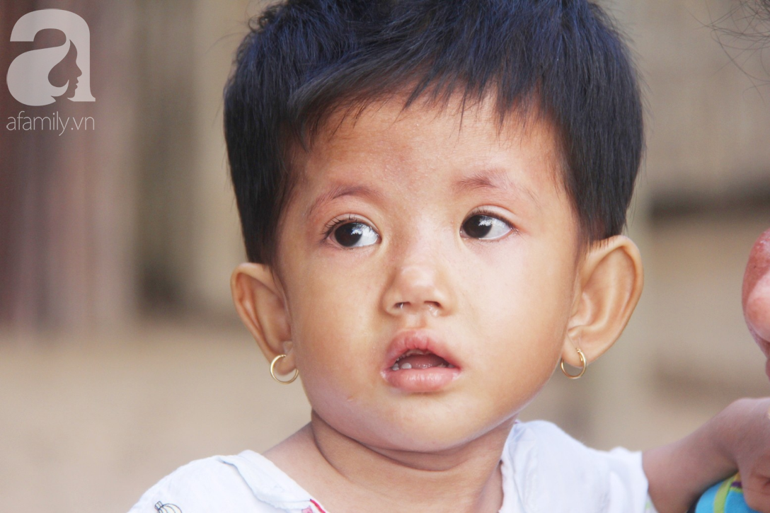 Lời khẩn cầu của người mẹ ôm con gái 2 tuổi bị hở van tim, chỉ nặng 6 ký mà không có tiền chạy chữa