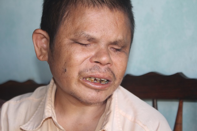 Người đàn ông mù đi ăn xin nuôi mẹ già bị ung thư