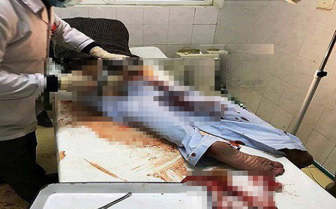 Can ngăn đánh nhau tại quán karaoke, nam thanh niên bị đâm trọng thương