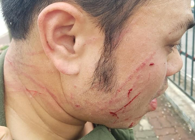 Báo cáo Thủ tướng vụ cò taxi đánh gãy răng nhân viên an ninh sân bay