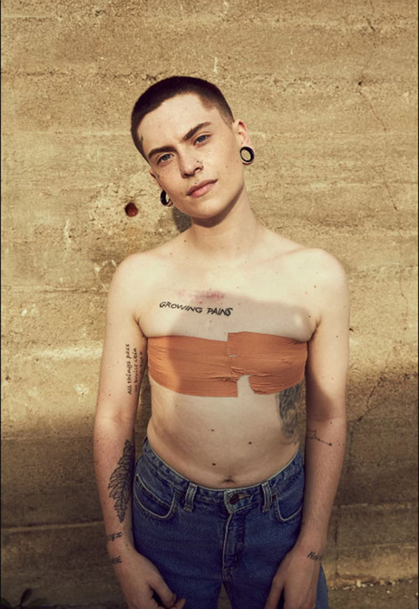 Bộ ảnh beauty cổ vũ cho những vẻ đẹp không hoàn hảo