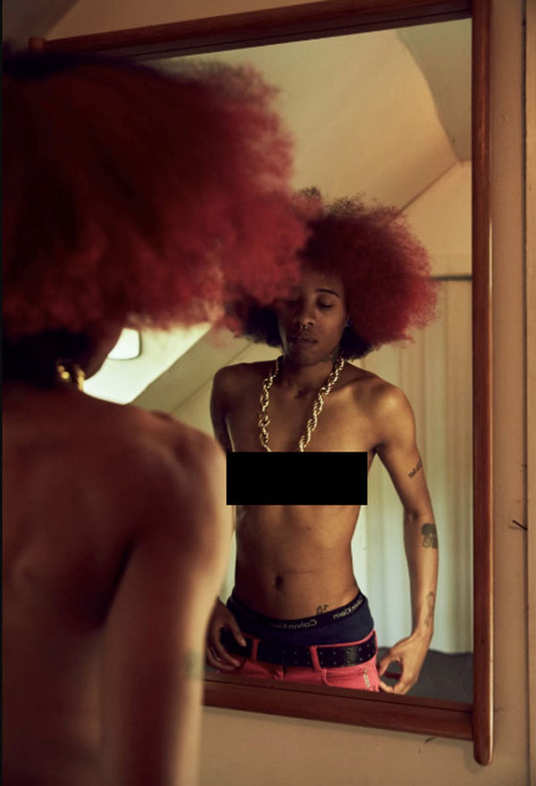 Bộ ảnh beauty cổ vũ cho những vẻ đẹp không hoàn hảo