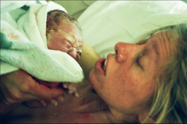 Bộ ảnh beauty cổ vũ cho những vẻ đẹp không hoàn hảo