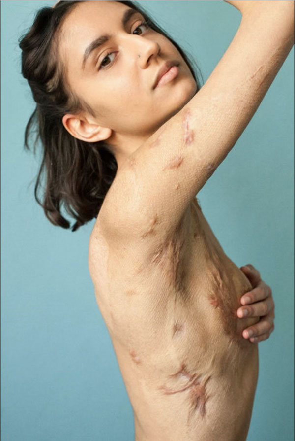 Bộ ảnh beauty cổ vũ cho những vẻ đẹp không hoàn hảo