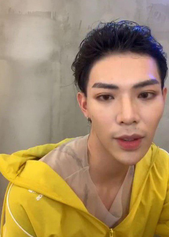 Gương mặt Erik ngày càng khác lạ do dao kéo quá đà?