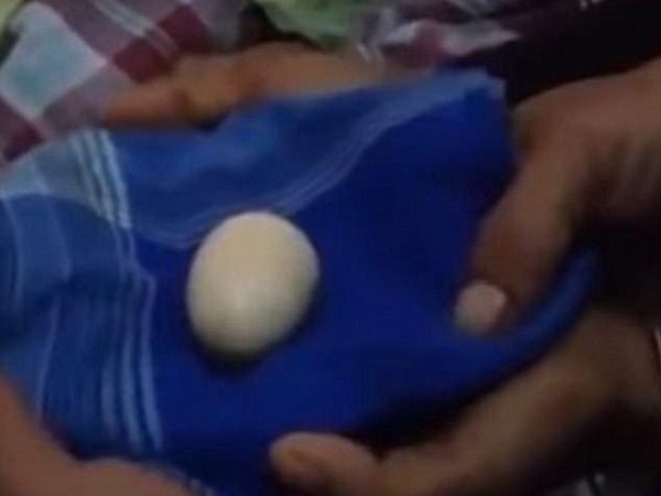 KHÓ TIN: Cậu bé người Indonesia đẻ 20 quả trứng đều đặn trong 2 năm