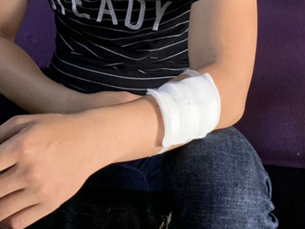 Nghe điện thoại ngoài đường, một người bị cướp chém vào tay