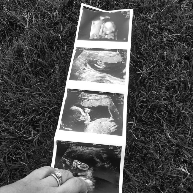 Bức thư của mẹ gửi con sơ sinh vừa qua đời sốt MXH: Xung quanh ai cũng áp con vào ngực, riêng mẹ thì không!