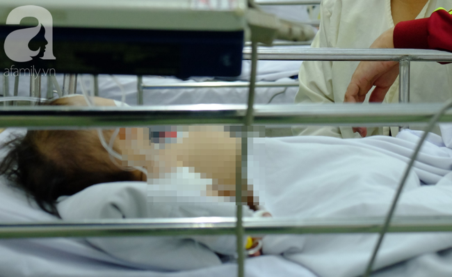 Bình xăng cũ phát nổ trong đống rác, bé 28 tháng tuổi tử vong vì bỏng nặng