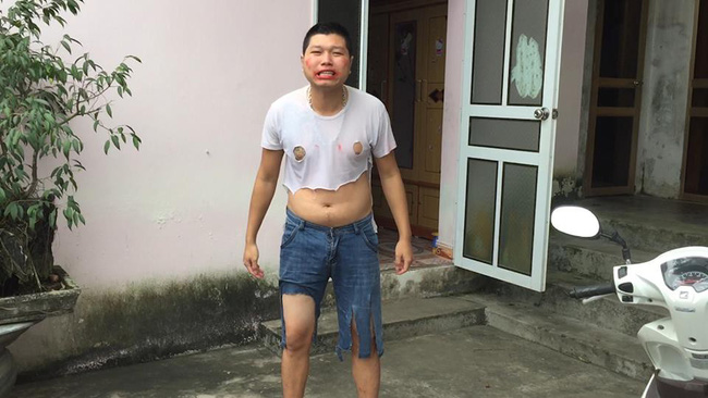 Rét run khi chứng kiến hình phạt của vợ khi chồng đi chơi, cư dân mạng khiếp vía hô hào không dám kết hôn nữa Rét run khi chứng kiến hình phạt của vợ khi chồng đi chơi, cư dân mạng khiếp vía hô hào không dám kết hôn nữa