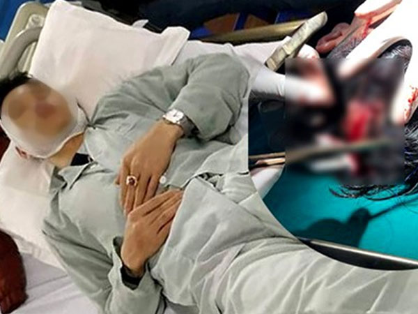 Sau va chạm giao thông, tài xế xe Mazda 3 bị chém toác đầu