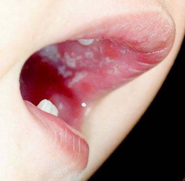 Để con trai ở nhà với ông bà nội, mẹ chết lặng khi bác sĩ nói con phải cắt lưỡi