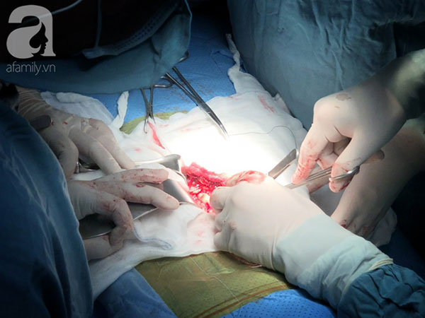 Đang khỏe mạnh, người đàn ông học theo MXH uống 1kg nước ép từ loại quả này thì bị suy thận