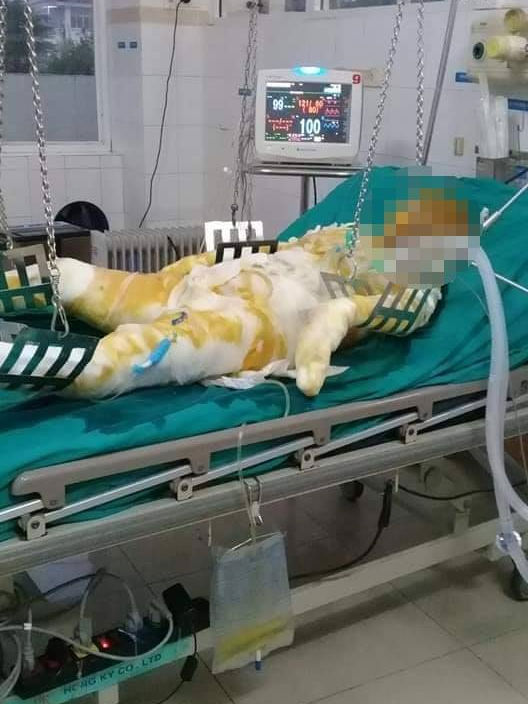 Điện Biên: Đang ở cùng 5 con nhỏ, vợ bị chồng tẩm xăng đốt tử vong