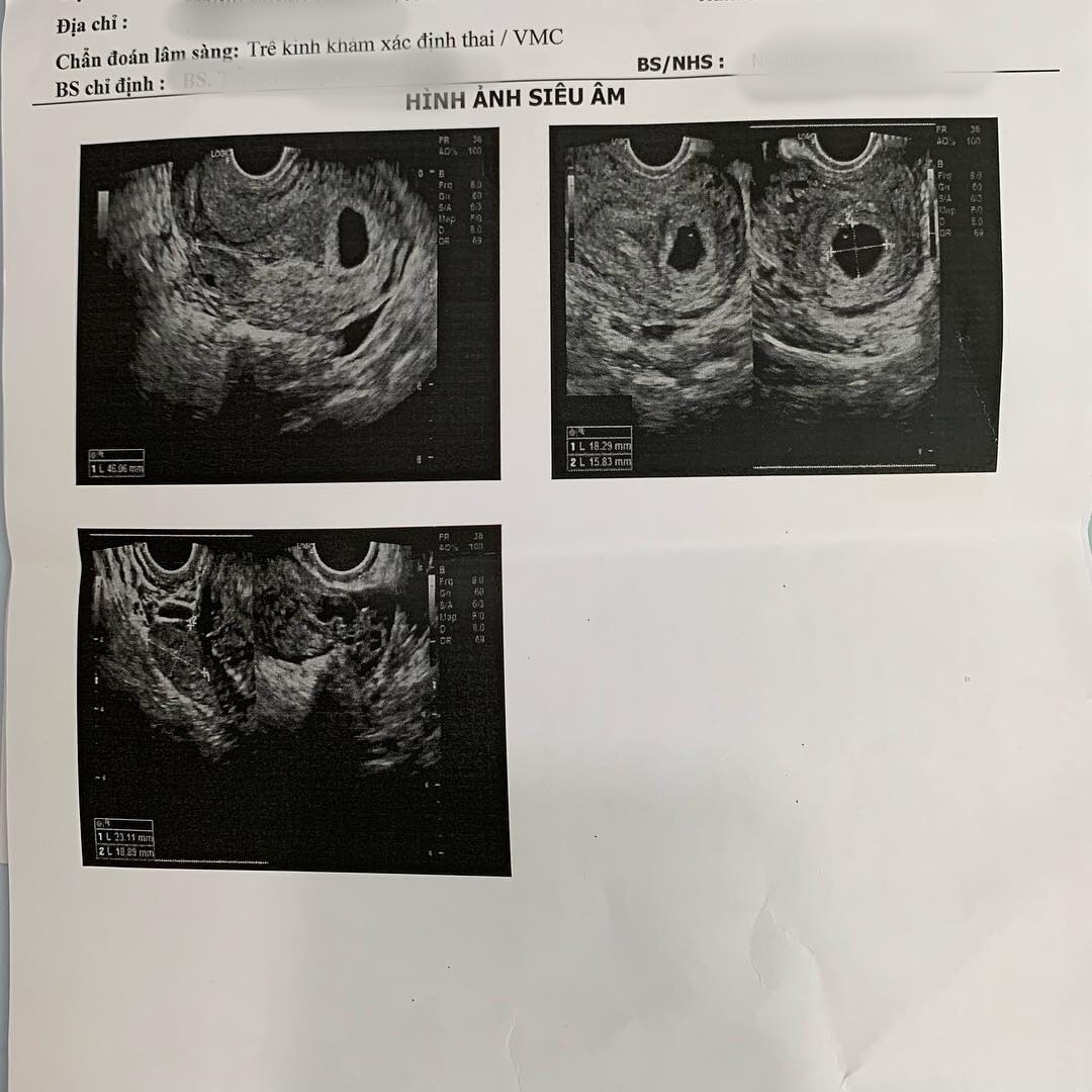 Hot mom triệu followers Thanh Trần khoe tin vui mang thai em bé thứ hai ở tuổi 23