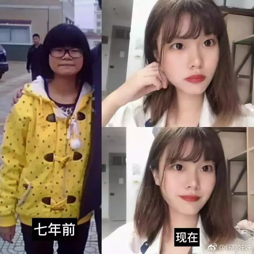 Chùm ảnh chứng minh chỉ cần lên Đại học là lột xác đẹp xuất sắc, hơn cả đi phẫu thuật thẩm mỹ