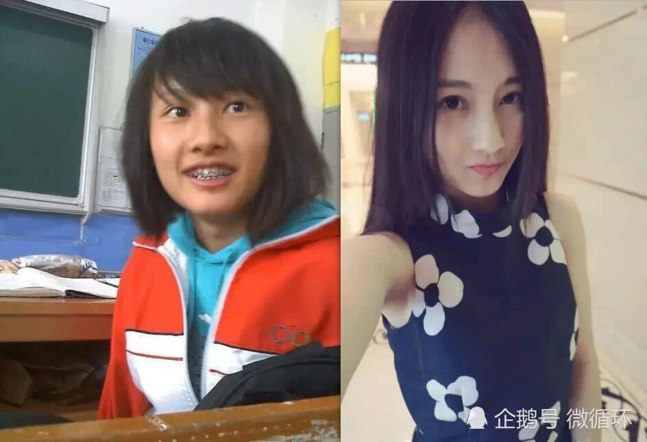 Chùm ảnh chứng minh chỉ cần lên Đại học là lột xác đẹp xuất sắc, hơn cả đi phẫu thuật thẩm mỹ